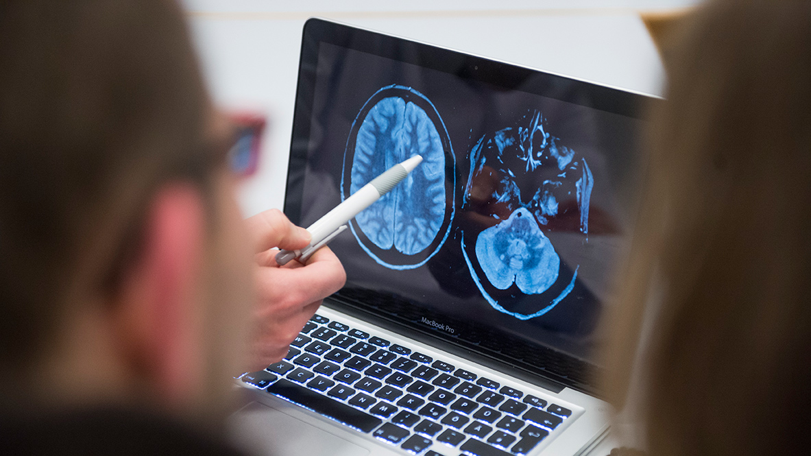 Ein Arzt erklärt einem MS-Patienten am Bildschirm MRT-Bilder des Gehirns.